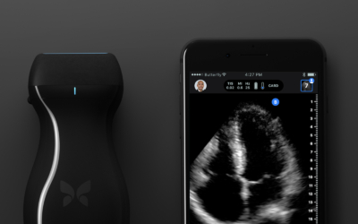 butterflyiq